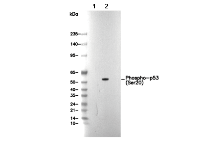 Phospho-p53 (Ser20) Antibody