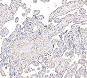 TGF β Receptor II Antibody