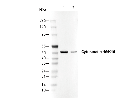 Cytokeratin 16/K16 Antibody
