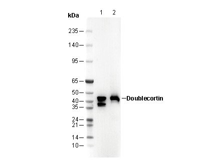Doublecortin Antibody