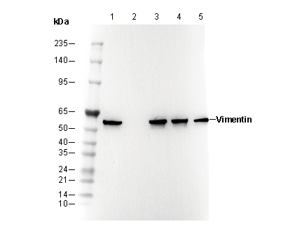 Vimentin Antibody