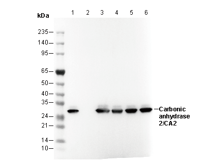 Carbonic anhydrase 2/CA2 Antibody