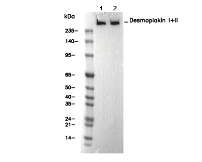 Desmoplakin I+II Antibody