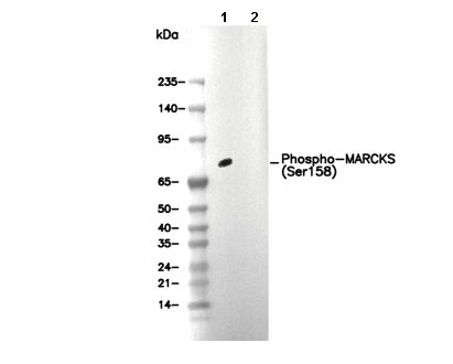 Phospho-MARCKS (Ser158) Antibody