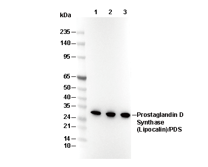 Prostaglandin D Synthase (Lipocalin)/PDS Antibody
