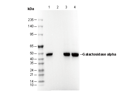 Galactosidase α Antibody