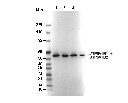 ATP6V1B1 + ATP6V1B2 Antibody