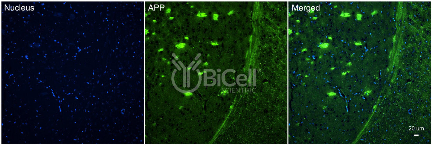 Amyloid-beta Precursor Protein (APP or AD1) Antibody - FFPE Validated
