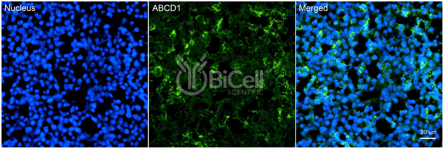 ABCD1 Antibody