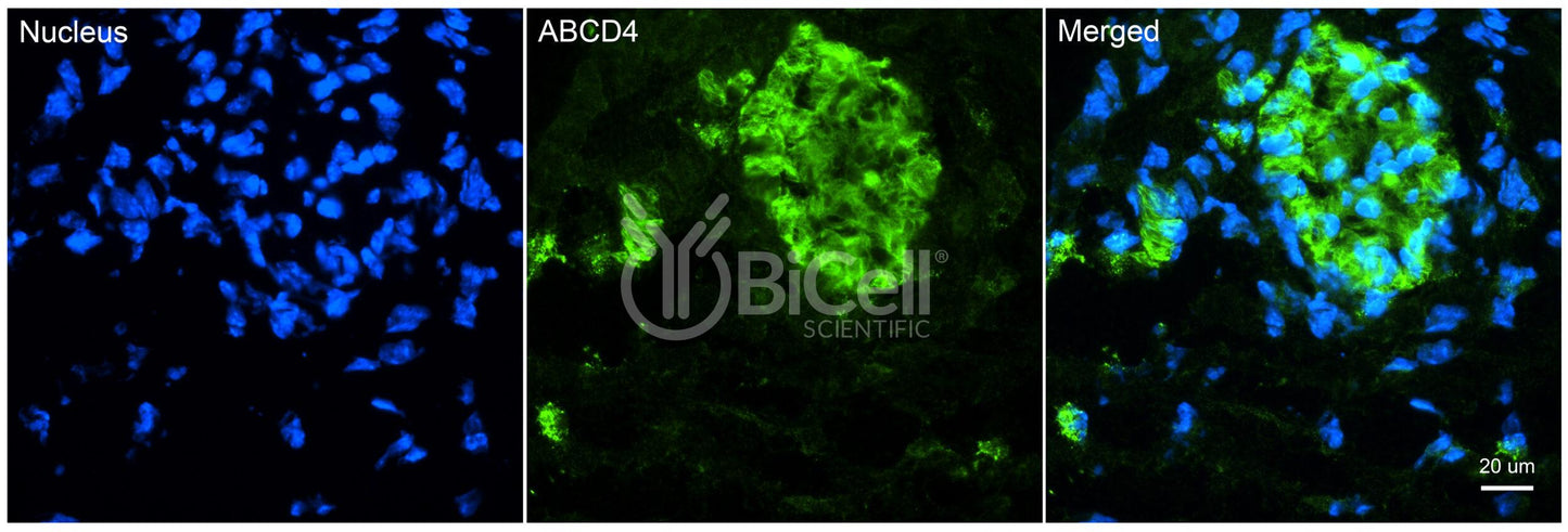 ABCD4 Antibody - Western Blot Validated