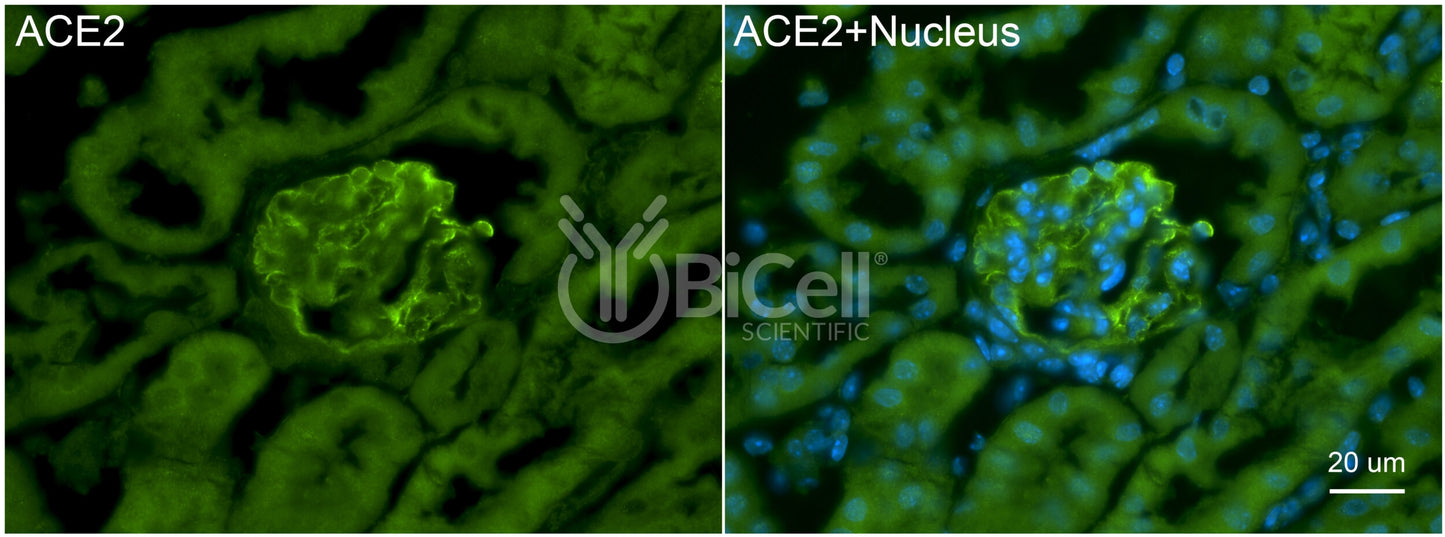 ACE2 Antibody