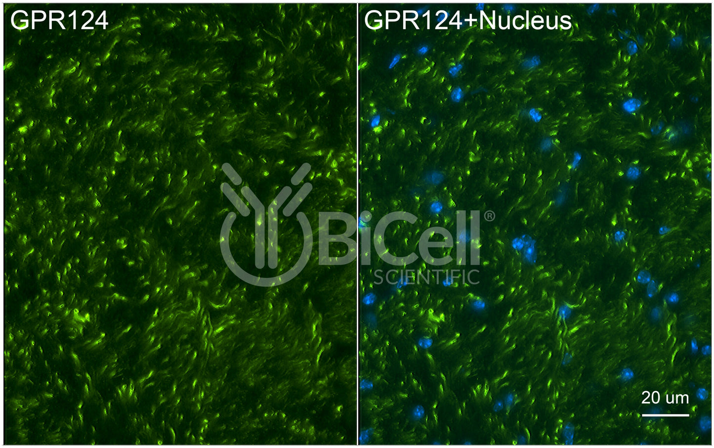 ADGRA2 (GPR124) Antibody - Western Blot Validated