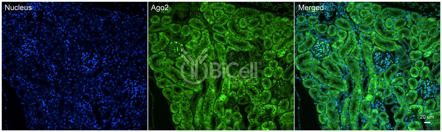 AGO2 Antibody - FFPE Validated