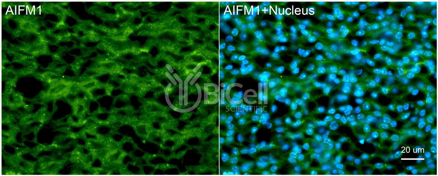 AIFM1 (AIF or AUNX1) Antibody - Western Blot Validated