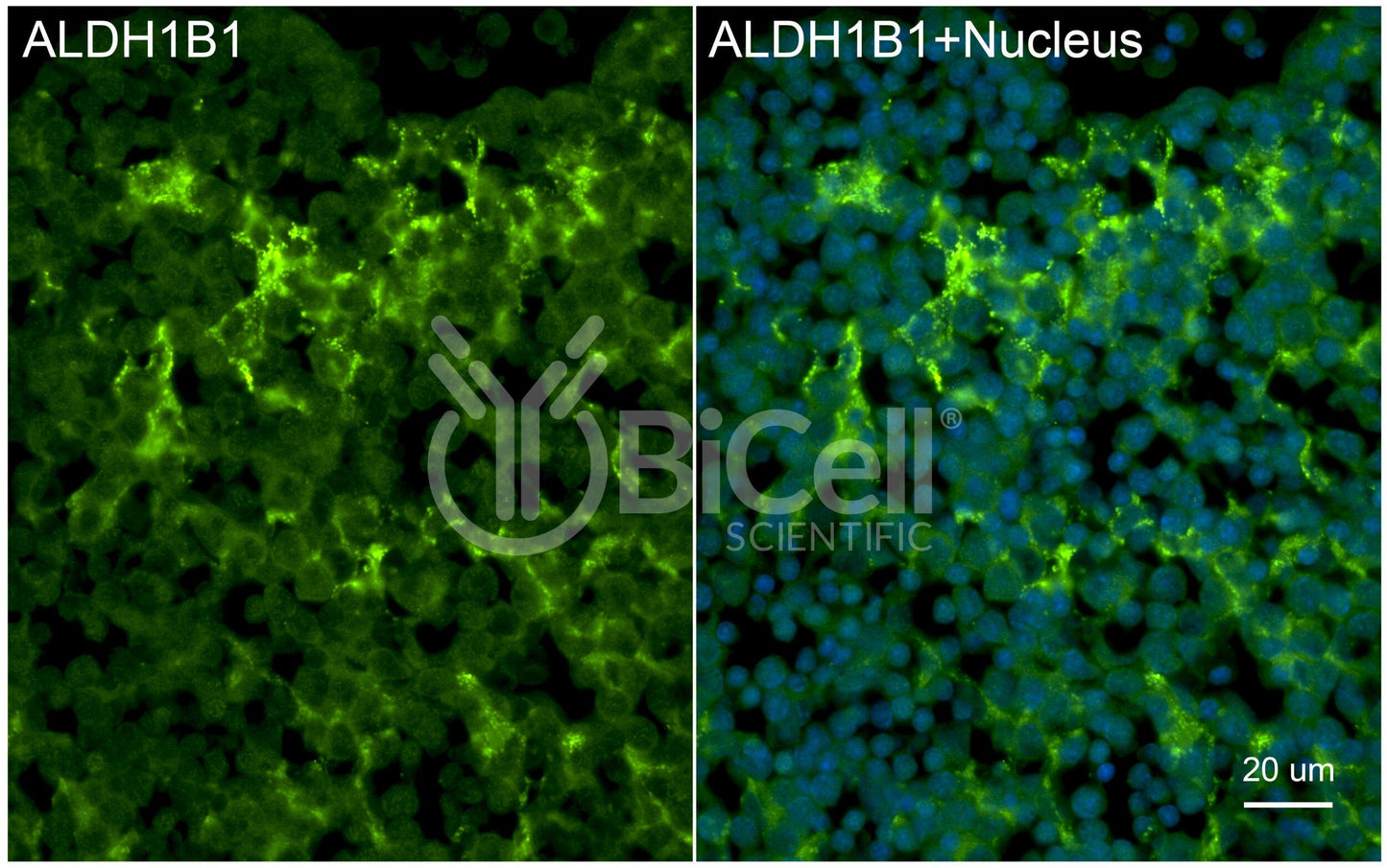 ALDH1B1 (ALDH5 or ALDHX) Antibody - Western Blot Validated