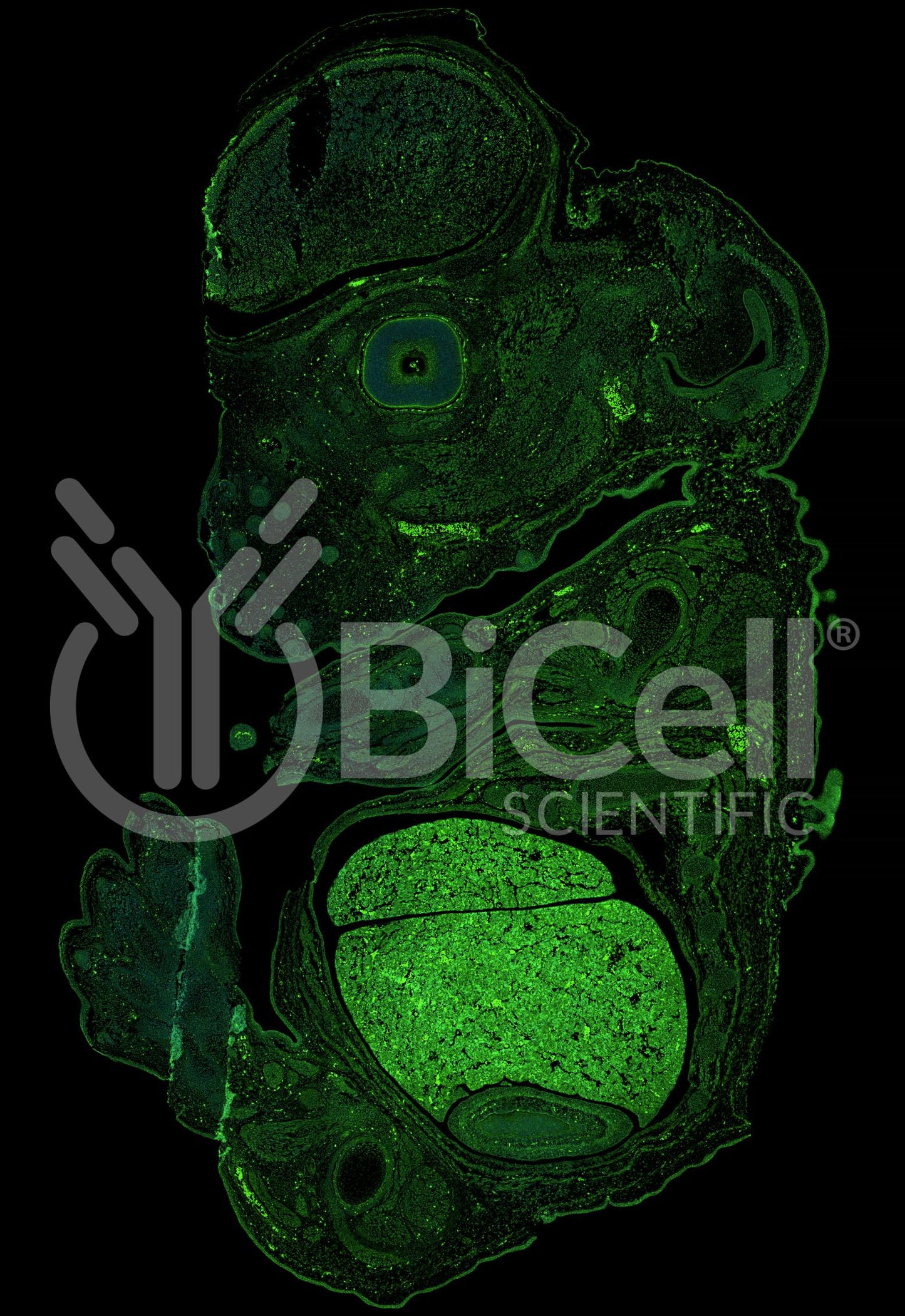 Anillin (ANLN or FSGS8) Antibody - FFPE Validated