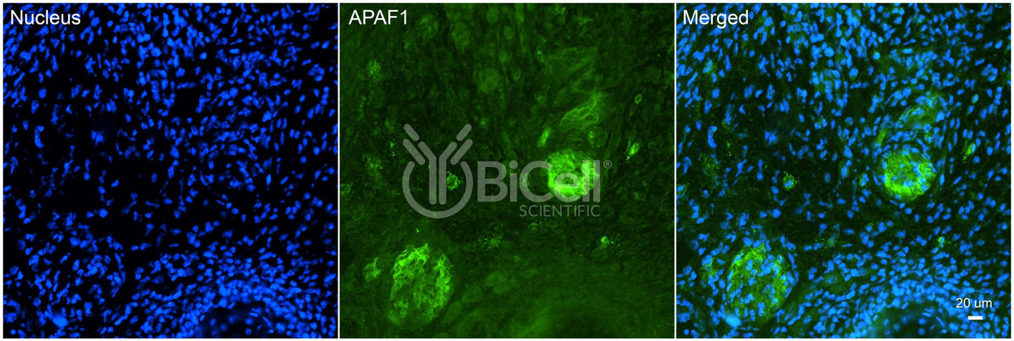 APAF1 (CED4) Antibody - FFPE Validated