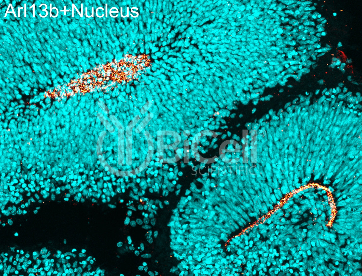 ARL13B (ARL2L1) HiRe Antibody