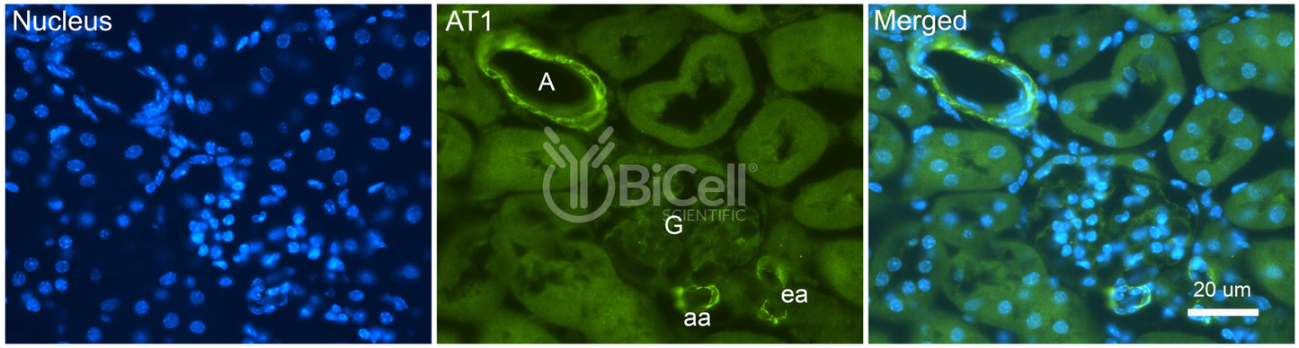 AGTR1 (AT1) Antibody