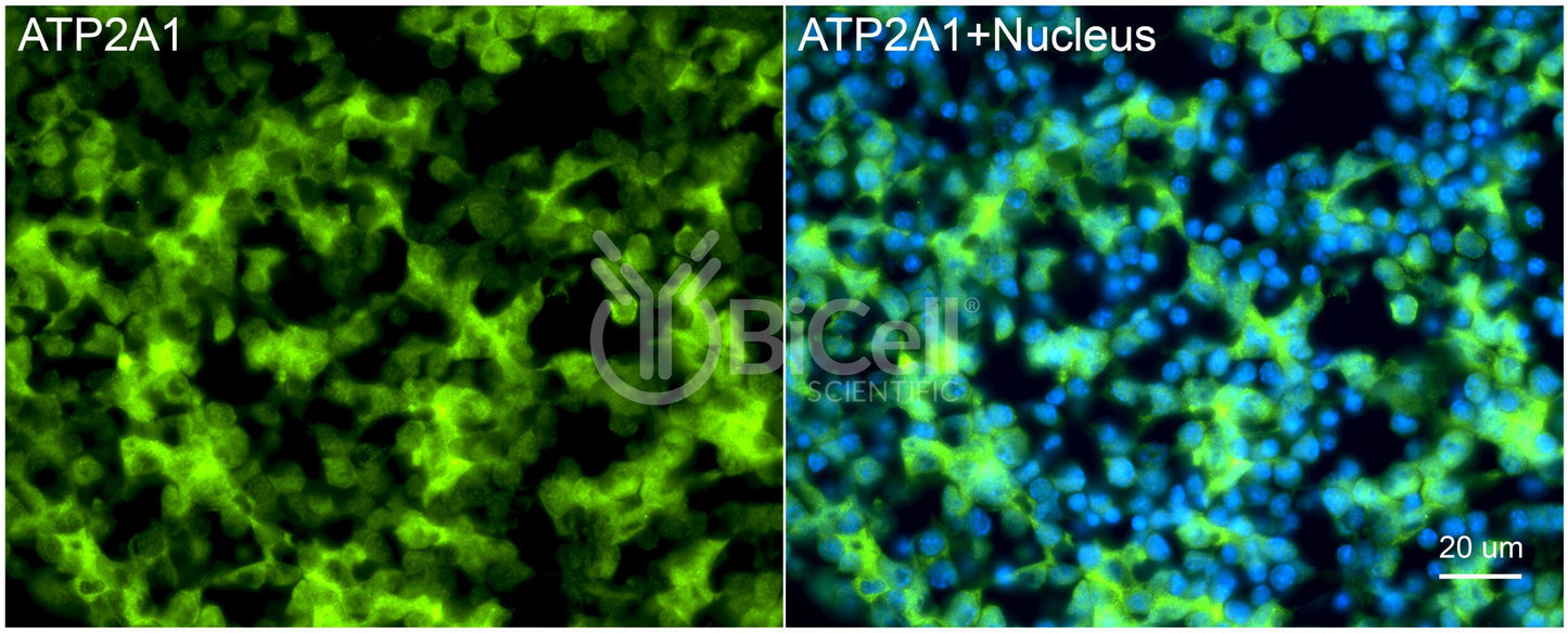ATP2A1 (SERCA1) Antibody - FFPE Validated