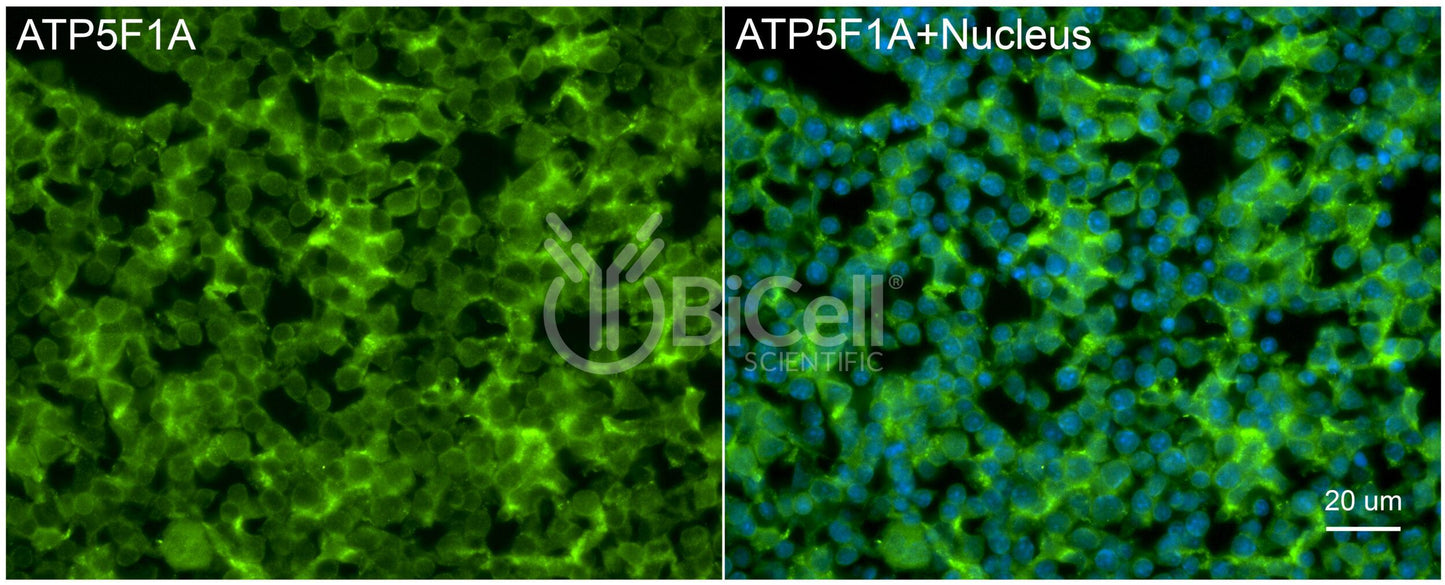 ATP5F1A (ATP5A) Antibody - FFPE Validated