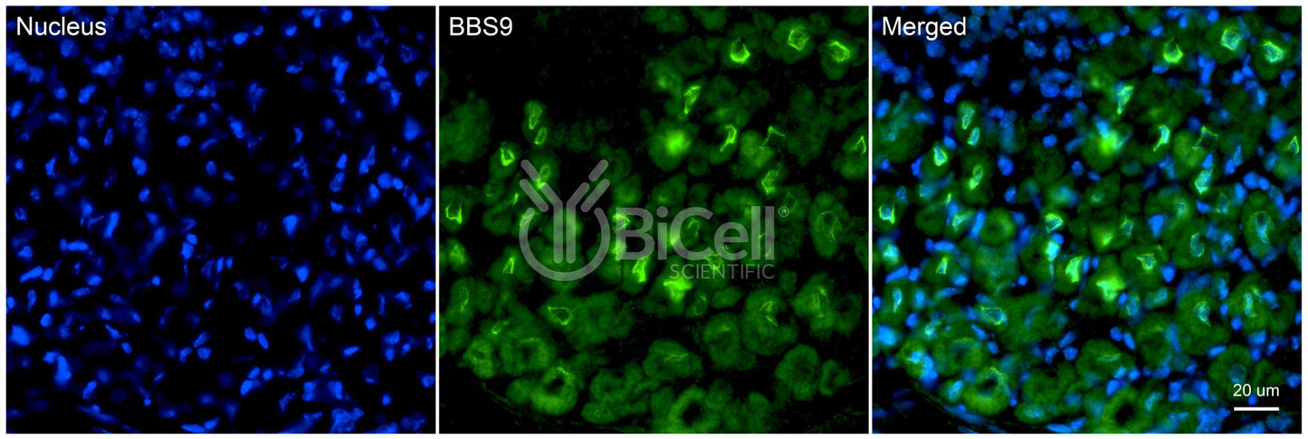 BBS9 (PTHB1) Antibody
