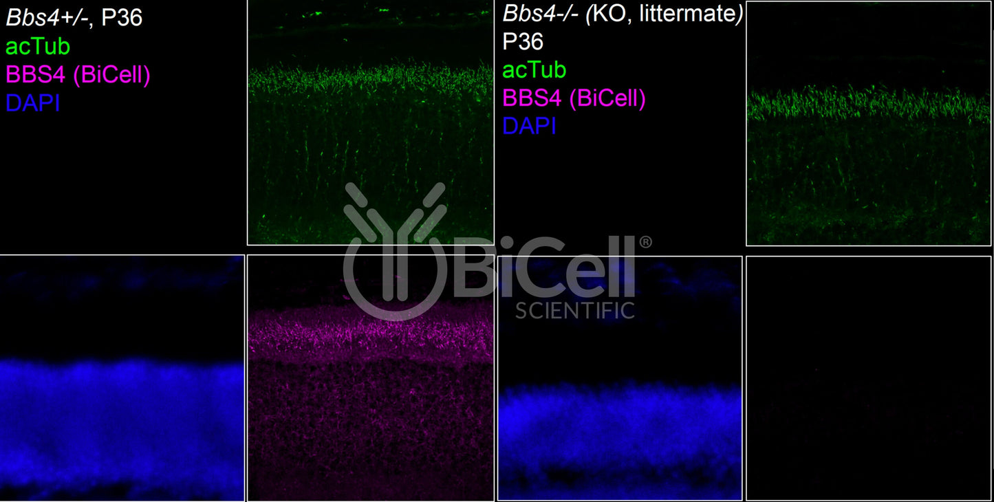 BBS4 Antibody - FFPE Validated