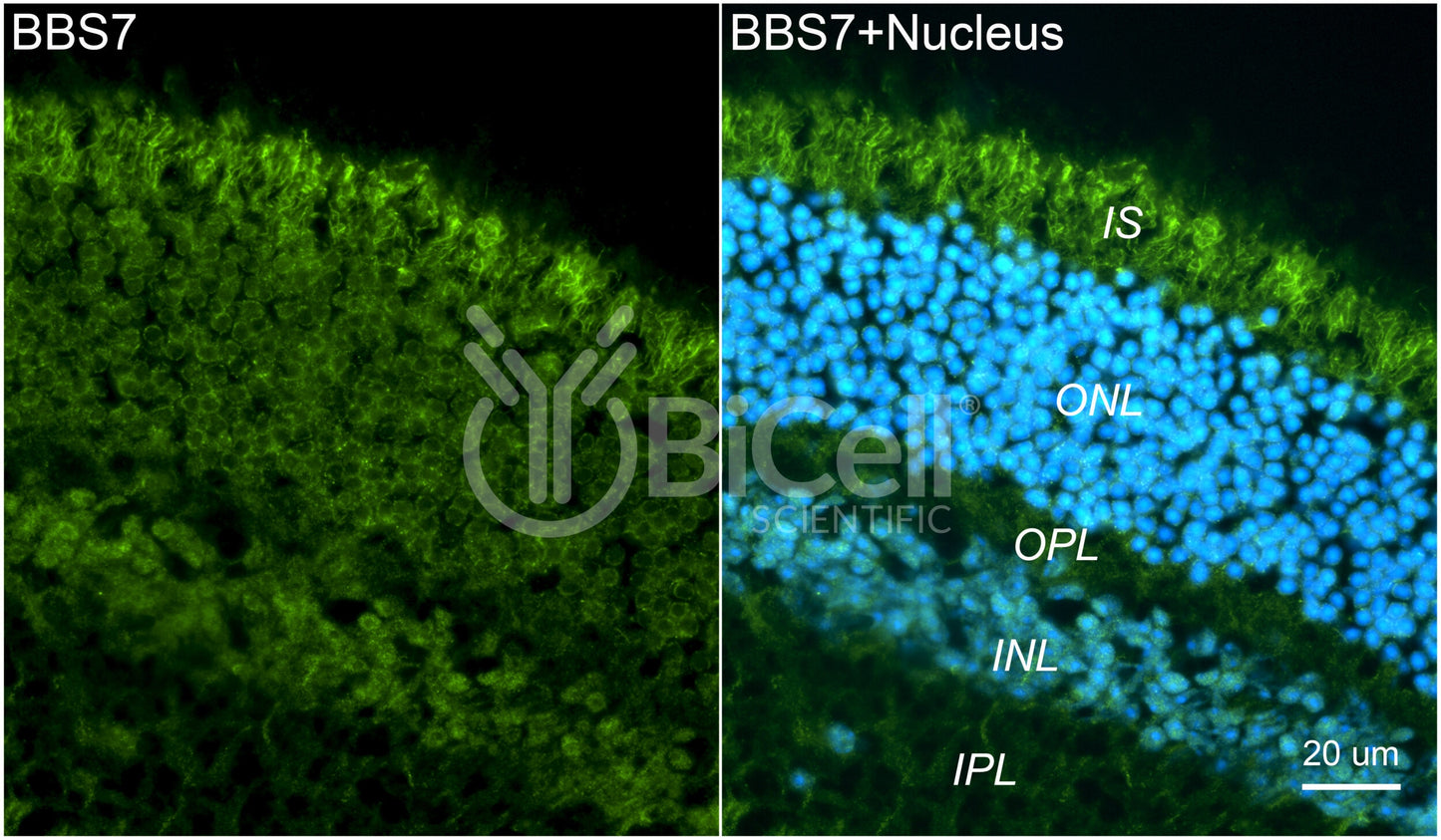 BBS7 Antibody