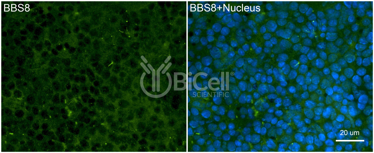 BBS8 (TTC8) Antibody