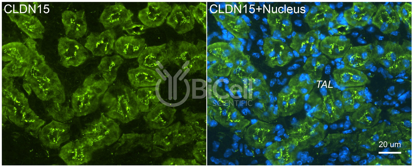Claudin-15 (CLDN15) Antibody - FFPE Validated