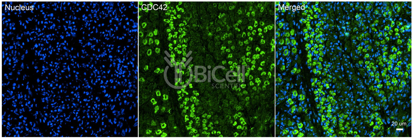 CDC42 Antibody - FFPE Validated