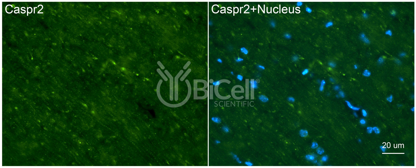 CASPR2 (CNTNAP2) Antibody - Western Blot Validated