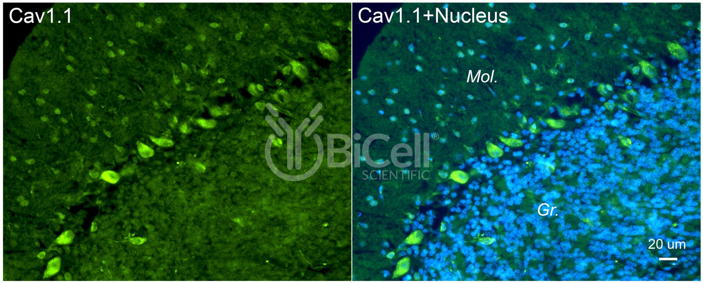 CACNA1S (Cav1.1) Antibody - FFPE Validated