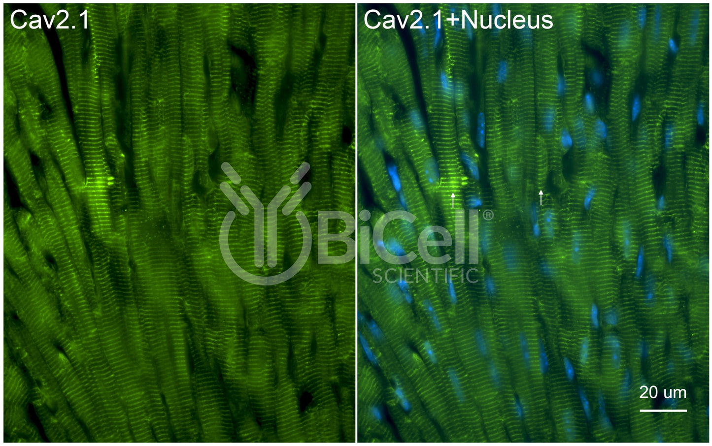 CACNA1A (Cav2.1) Antibody