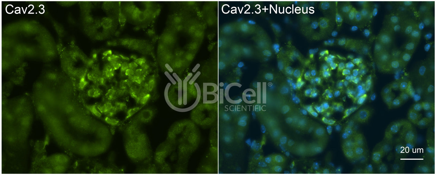 CACNA1E (Cav2.3) Antibody - Western Blot Validated