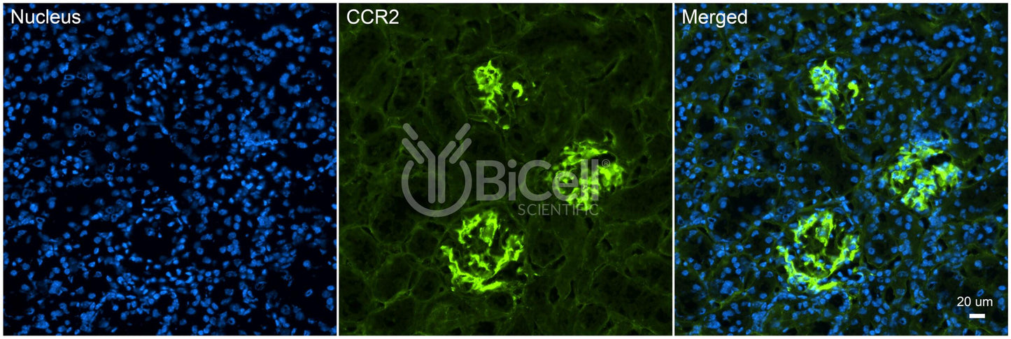 CCR2 (CD192) Antibody - FFPE Validated