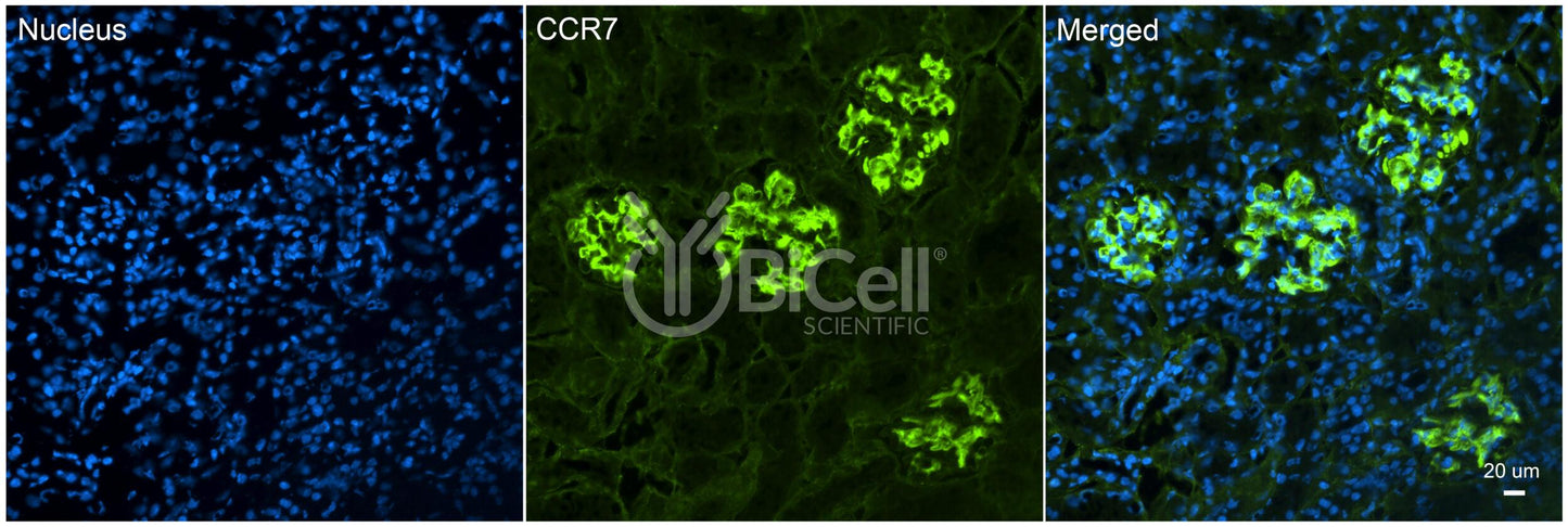 CCR7 (CD197) Antibody - FFPE Validated