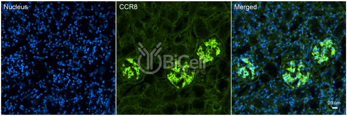 CCR8 (CDw198) Antibody - FFPE Validated
