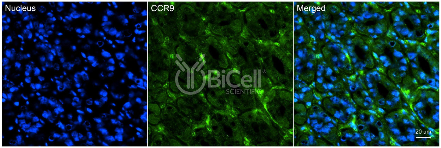 CCR9 (CDw199) Antibody - FFPE Validated