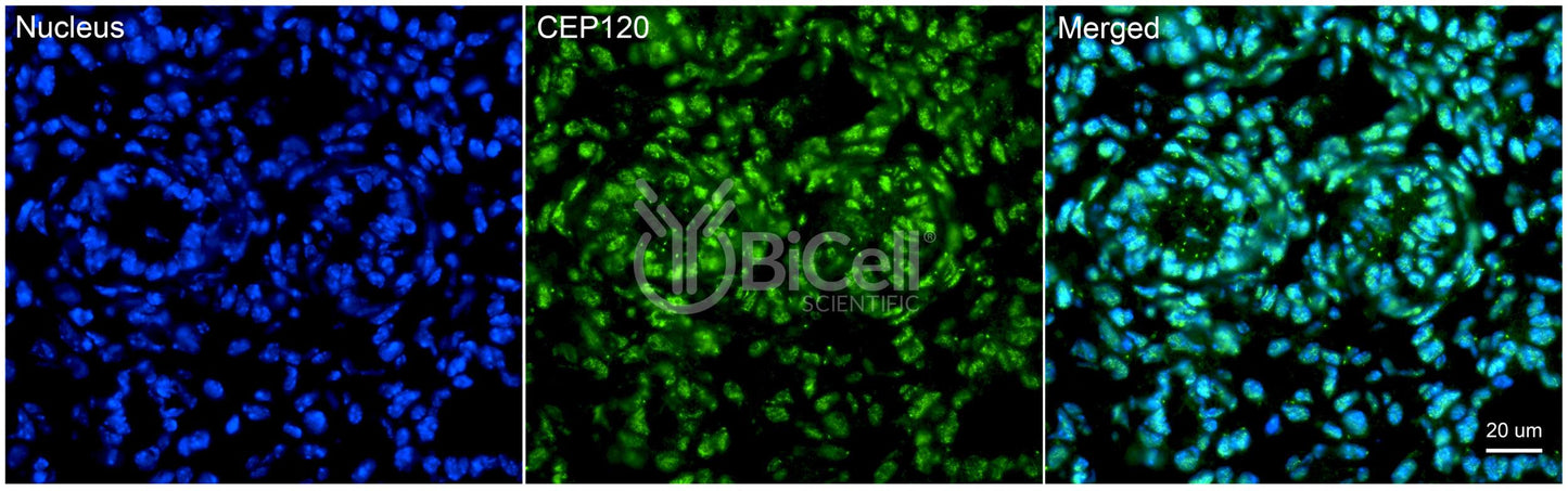 CEP120 (CCDC100) Antibody