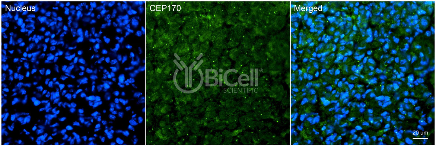 CEP170 (KIAA0470) Antibody - FFPE Validated