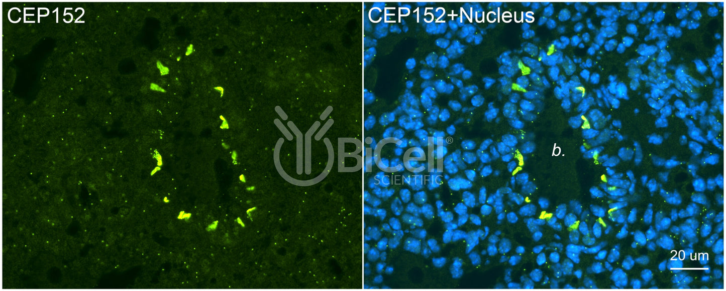 CEP152 Antibody