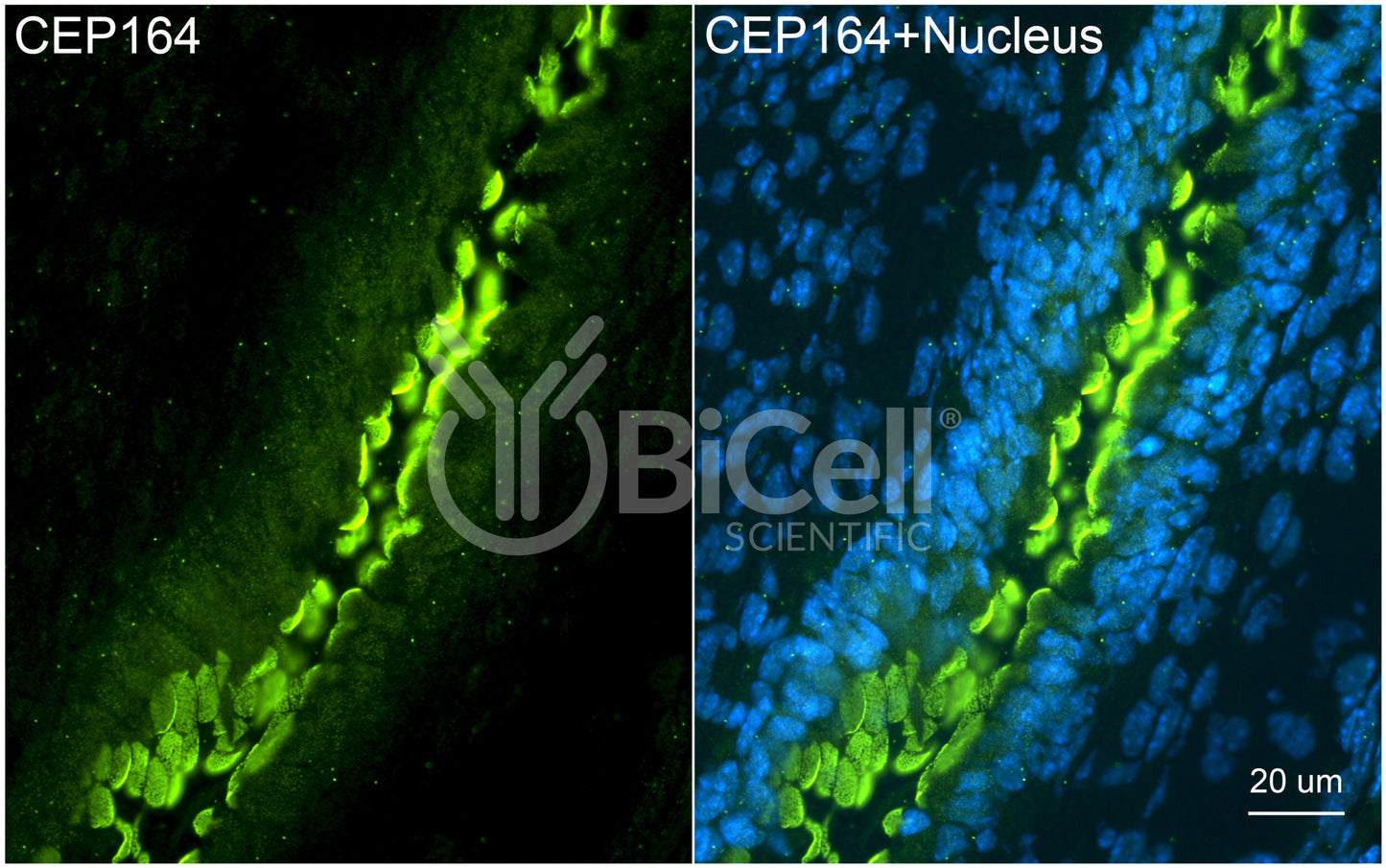 CEP164 (NPHP15) Antibody - Western Blot Validated