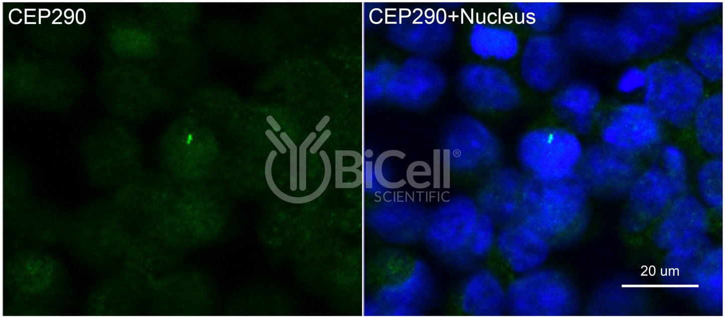 Nephrocystin-6 (Human) (NPHP6 or CEP290 or MKS4 or BBS14) Antibody - FFPE Validated