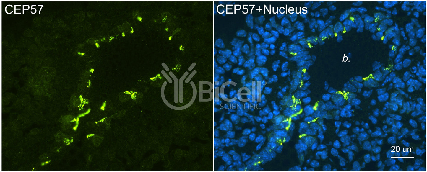 CEP57 Antibody - FFPE Validated