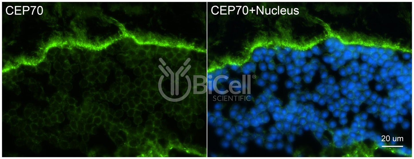 CEP70 Antibody - Western Blot Validated