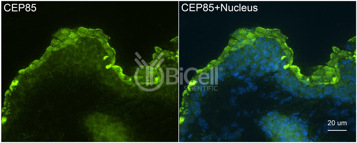 CEP85 (CCDC21) Antibody - FFPE Validated