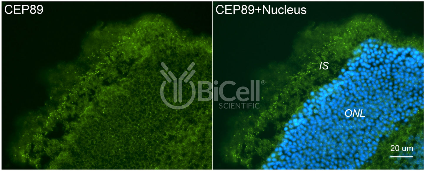 CEP89 (CCDC123) Antibody - FFPE Validated