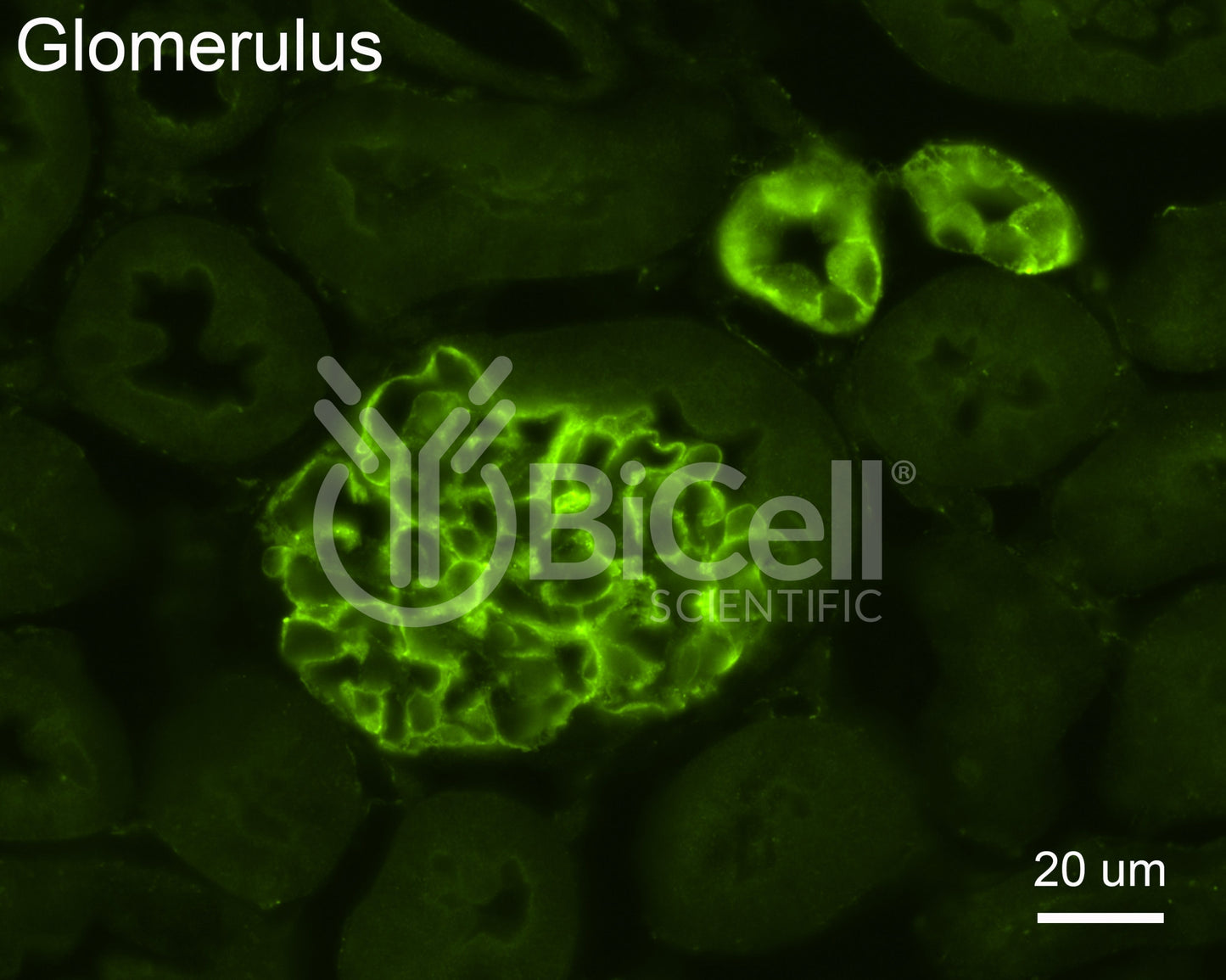 CFTR Antibody - Western Blot Validated