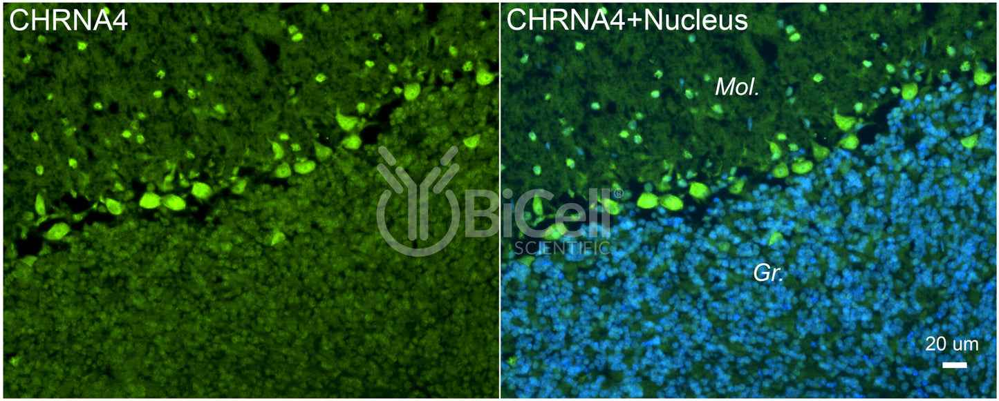 CHRNA4 (NACHRA4) Antibody - FFPE Validated